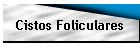 Cistos Foliculares
